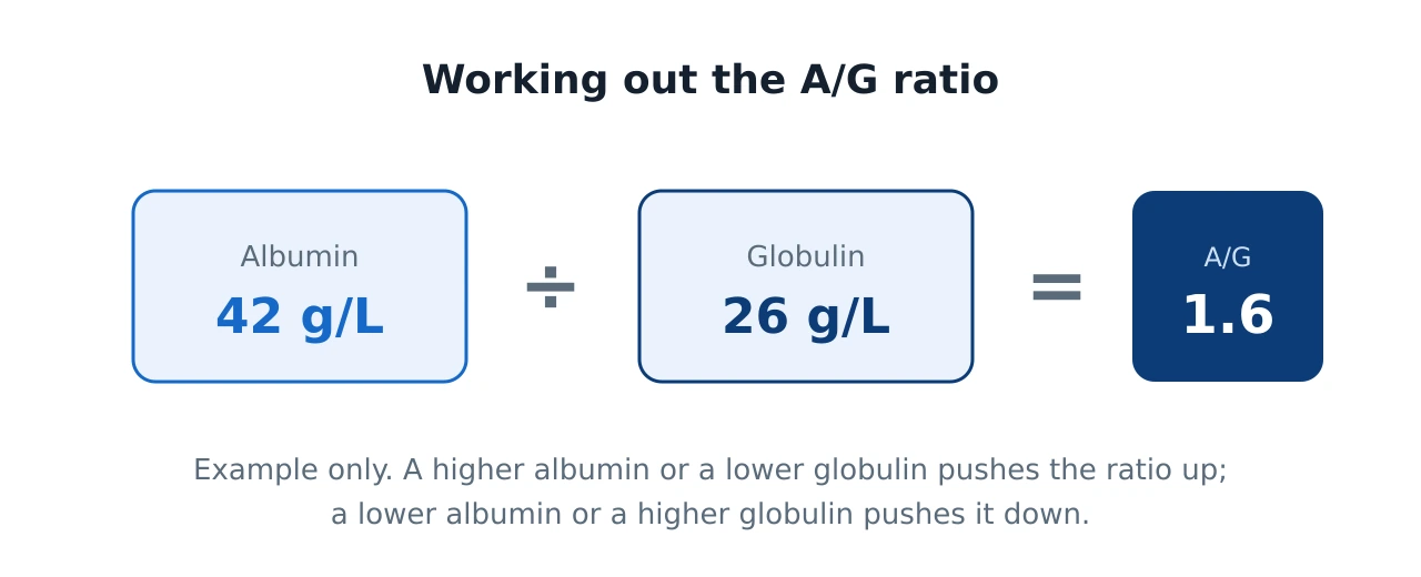 Formula panel showing A slash G ratio equals albumin about 42 divided by globulin about 26 giving roughly 1.6