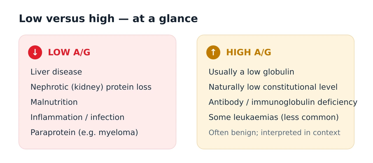Two column comparison of low A/G ratio causes such as liver disease, kidney protein loss, inflammation and paraprotein versus high A/G ratio causes such as low globulin, immunoglobulin deficiency and some leukaemias