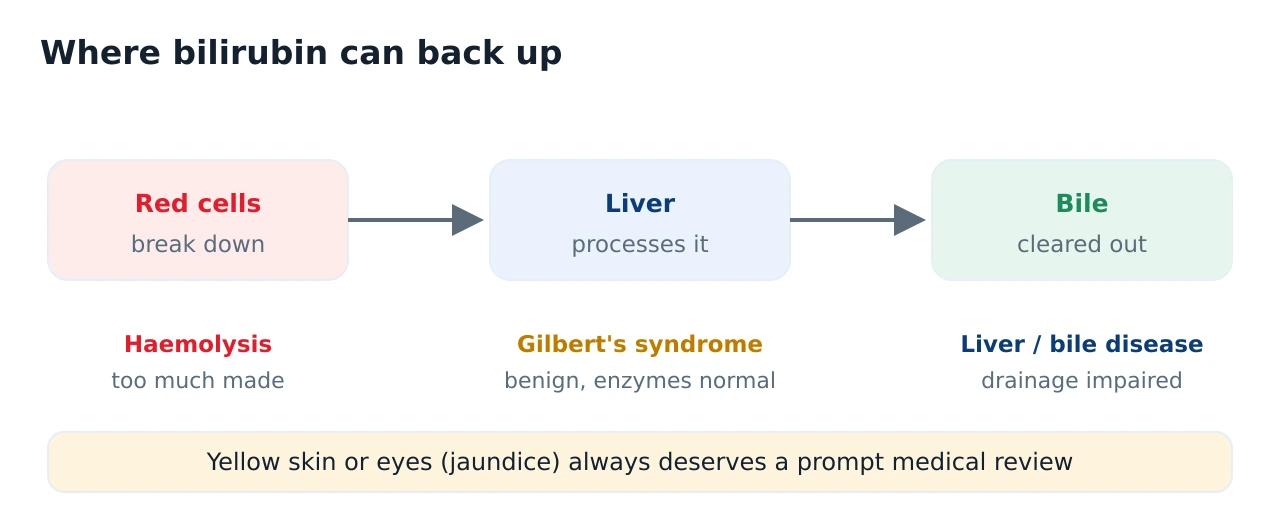 Flow diagram of bilirubin from red blood cell breakdown through the liver into bile, with three labelled points where it can build up: haemolysis, Gilbert's syndrome and liver or bile-duct disease