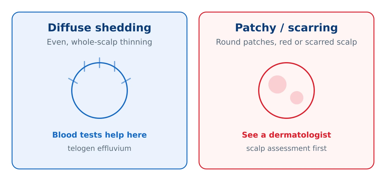 Diagram contrasting diffuse hair loss, which suits blood tests, with patchy and scarring hair loss, which need a dermatology scalp assessment