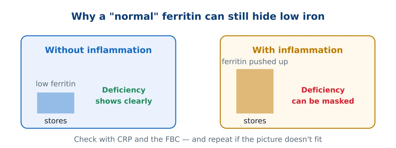 Diagram showing how inflammation can raise ferritin and mask true iron deficiency, so ferritin is read alongside CRP and the Full Blood Count